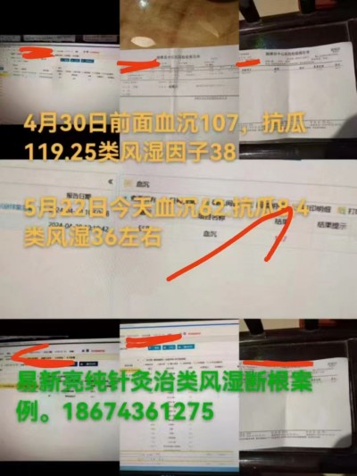 易新亮中医师：当中医针灸遇上现代科技，糖尿病与癌症、关节痛症的康复融合新路径