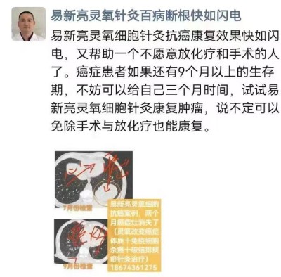 易新亮中医师：当中医针灸遇上现代科技，糖尿病与癌症、关节痛症的康复融合新路径
