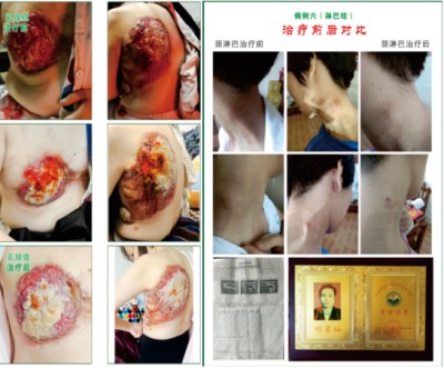杨宗仙：中医传承创新领路人，为民治病写下传奇故事